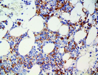 IHC of CD16 on a FFPE Bone Marrow Tissue